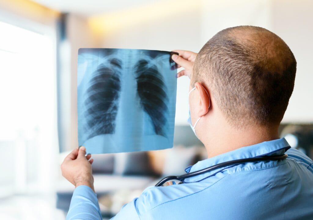 Best Pulmonologist in Raipur