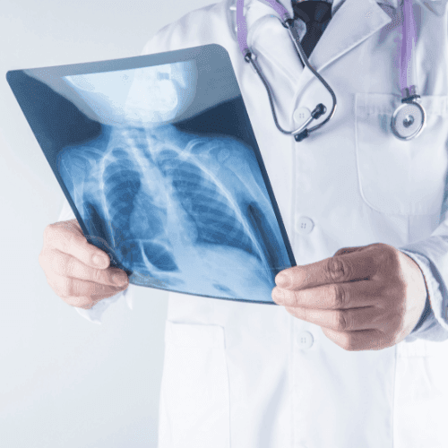 Best Pulmonologist In Chhattisgarh